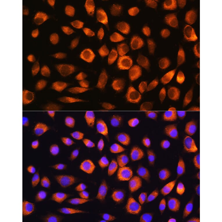 Immunofluorescence - Anti-Hsc70 Antibody (A14001) - Antibodies.com