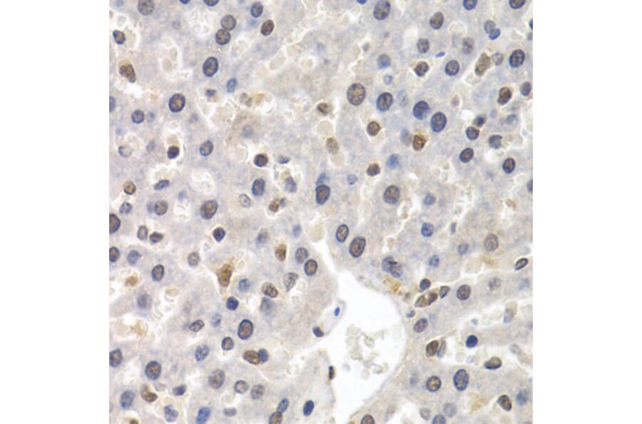 Immunohistochemistry - Anti-GTF2F1 Antibody (A2489) - Antibodies.com