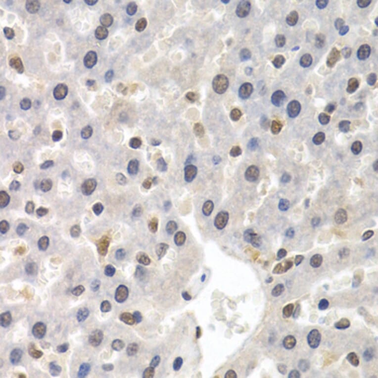 Immunohistochemistry - Anti-GTF2F1 Antibody (A2489) - Antibodies.com