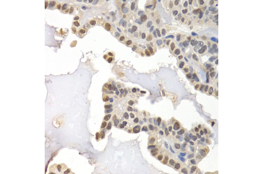Immunohistochemistry - Anti-GTF2F1 Antibody (A2489) - Antibodies.com