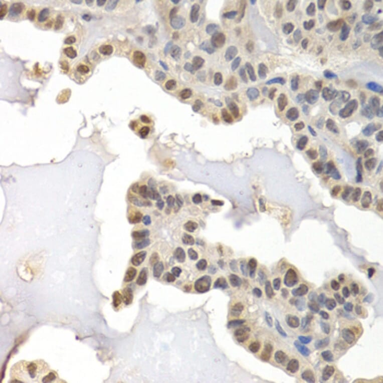 Immunohistochemistry - Anti-GTF2F1 Antibody (A2489) - Antibodies.com