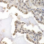Immunohistochemistry - Anti-GTF2F1 Antibody (A2489) - Antibodies.com