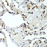 Immunohistochemistry - Anti-GTF2F1 Antibody (A2489) - Antibodies.com