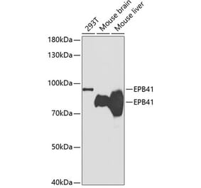 Western Blot - Anti-EPB41 Antibody (A14003) - Antibodies.com