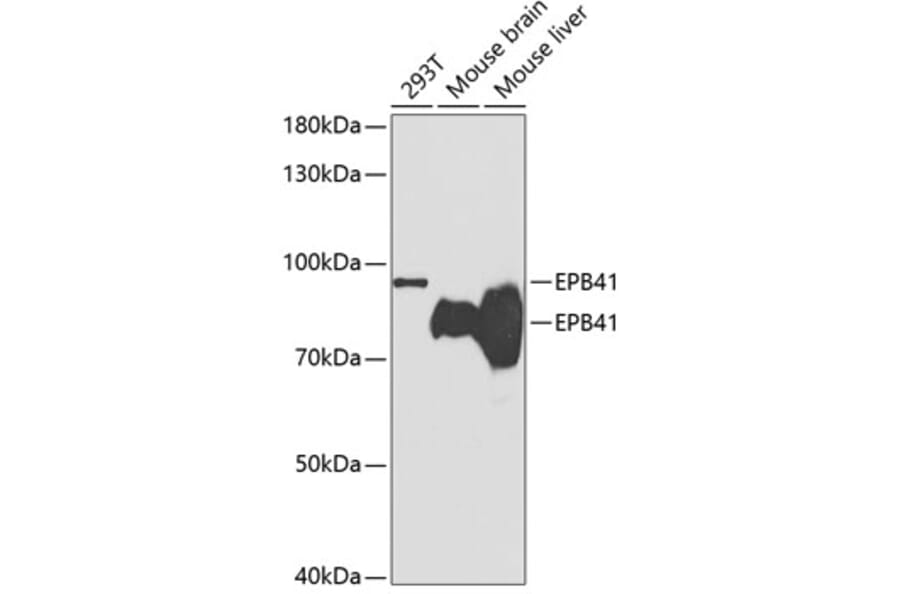 Western Blot - Anti-EPB41 Antibody (A14003) - Antibodies.com