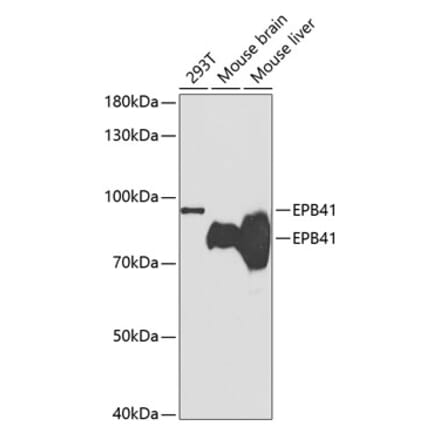 Western Blot - Anti-EPB41 Antibody (A14003) - Antibodies.com