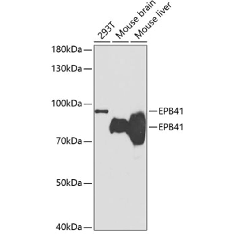 Western Blot - Anti-EPB41 Antibody (A14003) - Antibodies.com