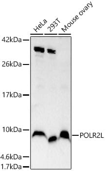 Immunohistochemistry of paraffin-embedded rat brain using Anti-POLR2L Antibody (A2491) at dilution of 1:200 (40x lens).