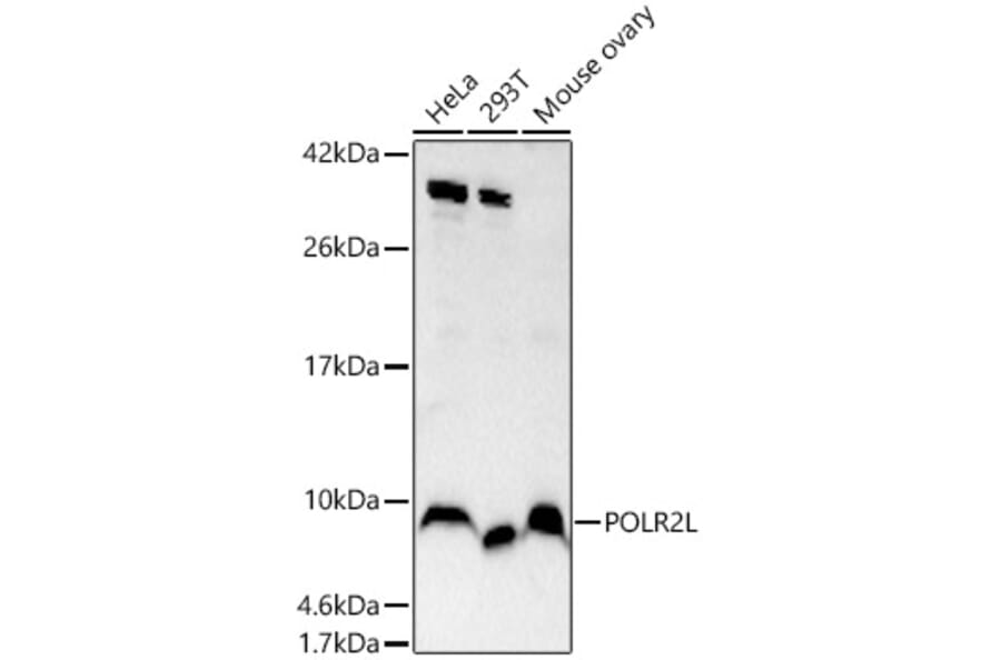 Western Blot - Anti-POLR2L Antibody (A14004) - Antibodies.com