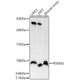 Western Blot - Anti-POLR2L Antibody (A14004) - Antibodies.com