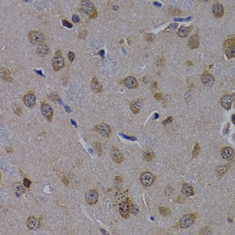 Immunohistochemistry - Anti-POLR2L Antibody (A14004) - Antibodies.com