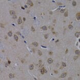 Immunohistochemistry - Anti-POLR2L Antibody (A14004) - Antibodies.com