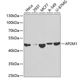Western Blot - Anti-AP2M1 Antibody (A14005) - Antibodies.com