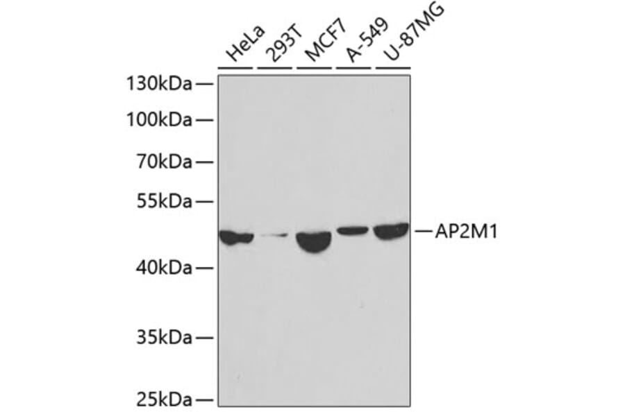 Western Blot - Anti-AP2M1 Antibody (A14005) - Antibodies.com