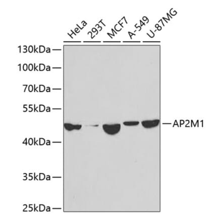 Western Blot - Anti-AP2M1 Antibody (A14005) - Antibodies.com