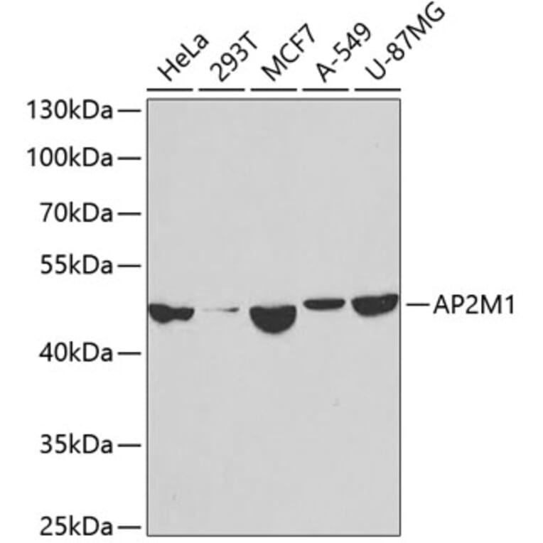 Western Blot - Anti-AP2M1 Antibody (A14005) - Antibodies.com