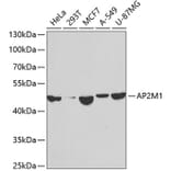 Western Blot - Anti-AP2M1 Antibody (A14005) - Antibodies.com