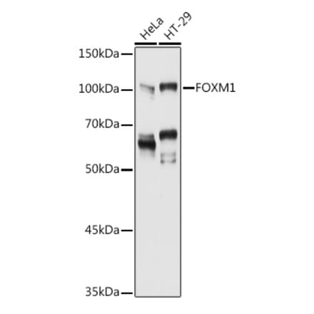 Western Blot - Anti-FOXM1 Antibody (A14006) - Antibodies.com