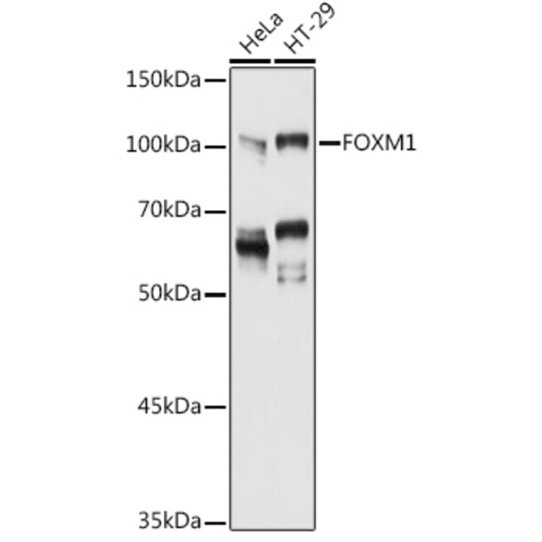 Western Blot - Anti-FOXM1 Antibody (A14006) - Antibodies.com