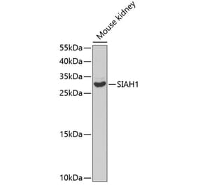 Western Blot - Anti-SIAH1 Antibody (A14007) - Antibodies.com
