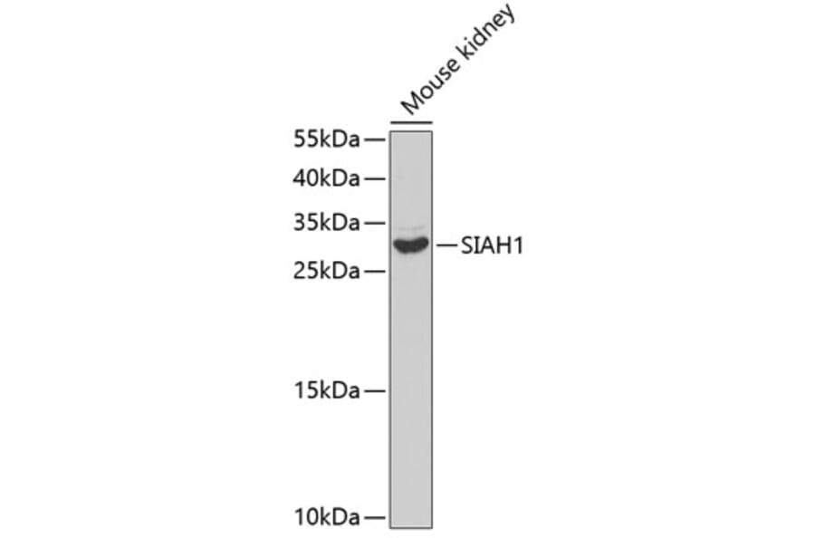 Western Blot - Anti-SIAH1 Antibody (A14007) - Antibodies.com