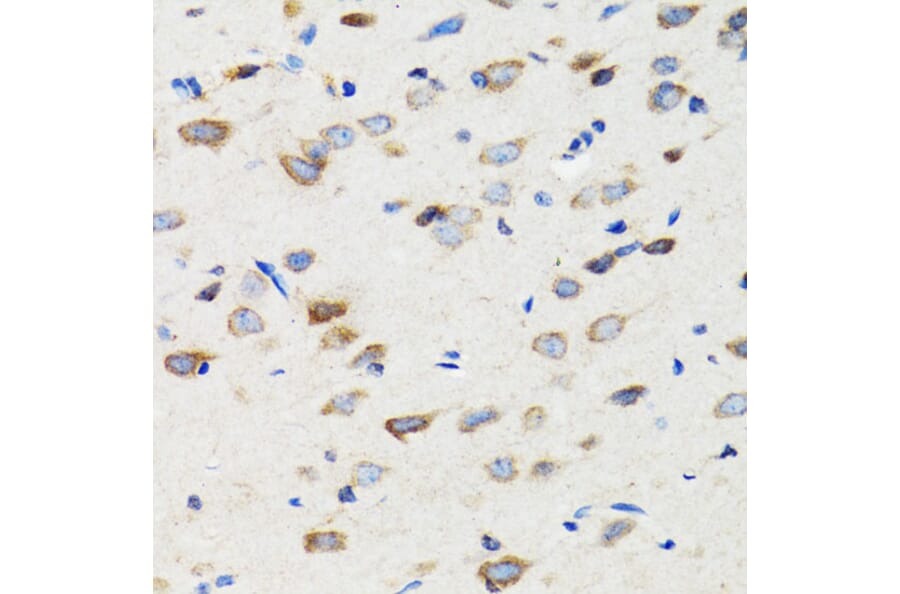 Immunohistochemistry - Anti-SIAH1 Antibody (A14007) - Antibodies.com