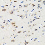 Immunohistochemistry - Anti-SIAH1 Antibody (A14007) - Antibodies.com