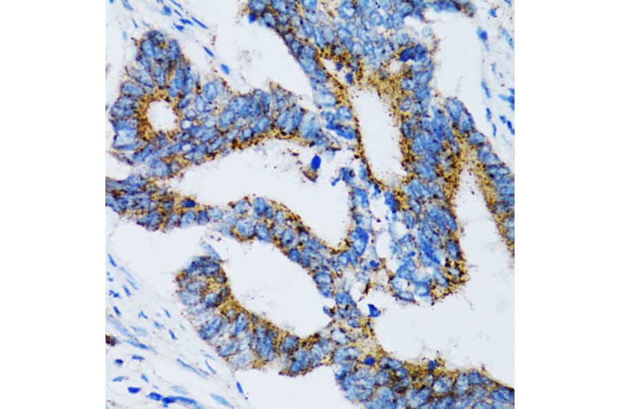 Immunohistochemistry - Anti-SIAH1 Antibody (A14007) - Antibodies.com