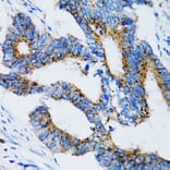 Immunohistochemistry - Anti-SIAH1 Antibody (A14007) - Antibodies.com