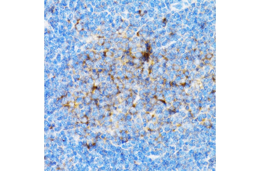 Immunohistochemistry - Anti-SIAH1 Antibody (A14007) - Antibodies.com