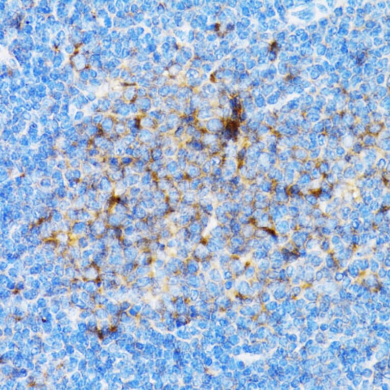 Immunohistochemistry - Anti-SIAH1 Antibody (A14007) - Antibodies.com