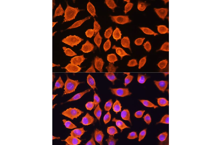 Immunofluorescence - Anti-SIAH1 Antibody (A14007) - Antibodies.com