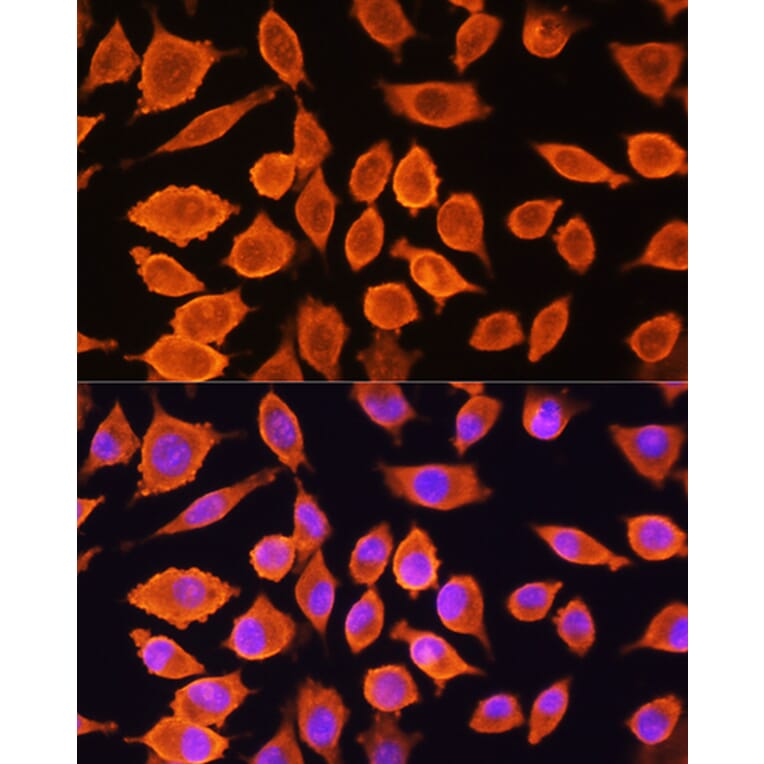 Immunofluorescence - Anti-SIAH1 Antibody (A14007) - Antibodies.com