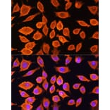 Immunofluorescence - Anti-SIAH1 Antibody (A14007) - Antibodies.com