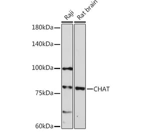 Western Blot - Anti-Choline Acetyltransferase Antibody (A14008) - Antibodies.com