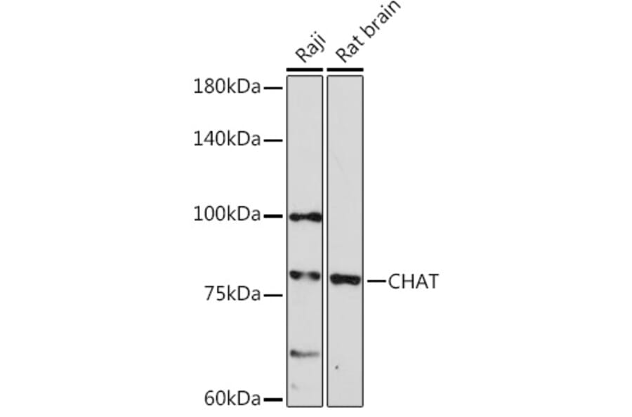 Western Blot - Anti-Choline Acetyltransferase Antibody (A14008) - Antibodies.com