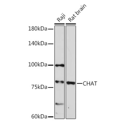 Western Blot - Anti-Choline Acetyltransferase Antibody (A14008) - Antibodies.com