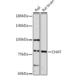 Western Blot - Anti-Choline Acetyltransferase Antibody (A14008) - Antibodies.com