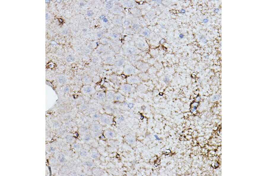 Immunohistochemistry - Anti-Choline Acetyltransferase Antibody (A14008) - Antibodies.com