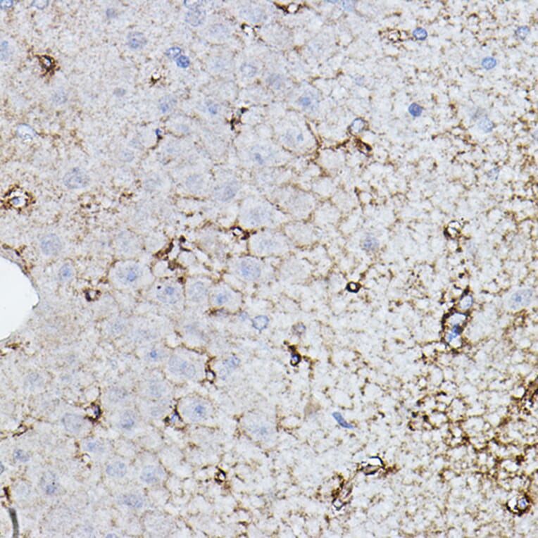 Immunohistochemistry - Anti-Choline Acetyltransferase Antibody (A14008) - Antibodies.com