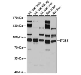 Western Blot - Anti-Integrin beta 5 Antibody (A14009) - Antibodies.com