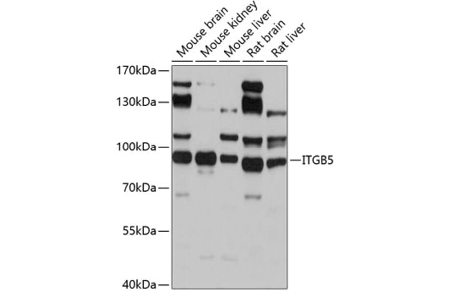 Western Blot - Anti-Integrin beta 5 Antibody (A14009) - Antibodies.com