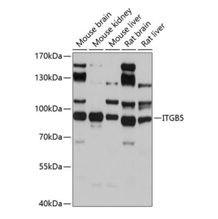 Western Blot - Anti-Integrin beta 5 Antibody (A14009) - Antibodies.com
