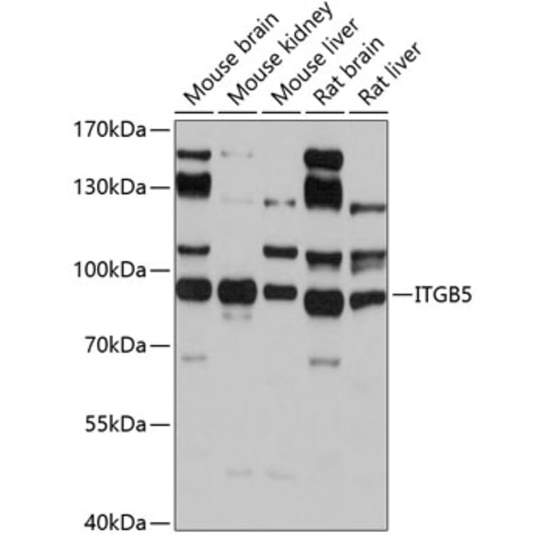 Western Blot - Anti-Integrin beta 5 Antibody (A14009) - Antibodies.com