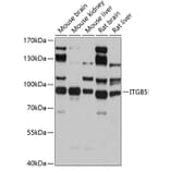 Western Blot - Anti-Integrin beta 5 Antibody (A14009) - Antibodies.com