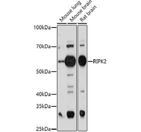 Western Blot - Anti-RIP2 Antibody (A14010) - Antibodies.com