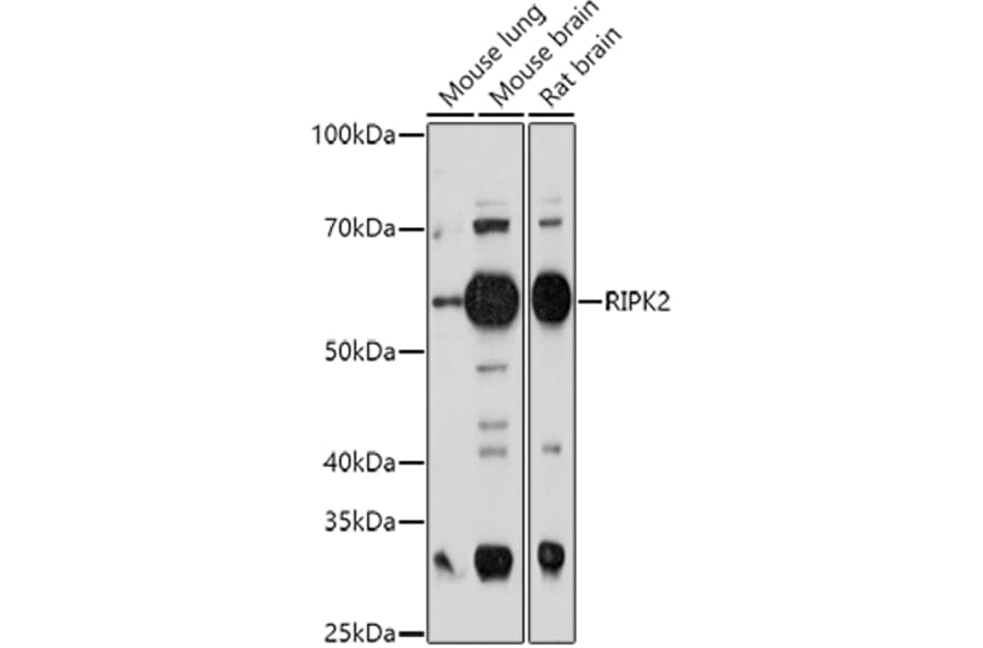 Western Blot - Anti-RIP2 Antibody (A14010) - Antibodies.com