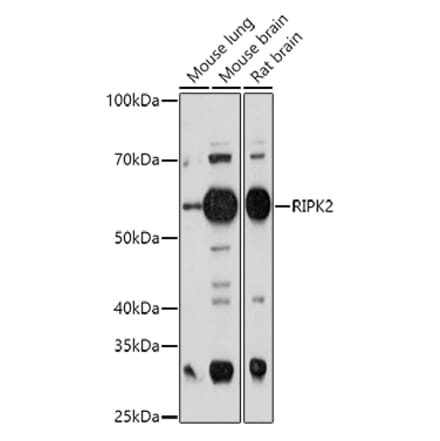 Western Blot - Anti-RIP2 Antibody (A14010) - Antibodies.com