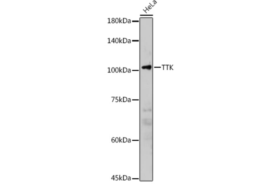 Western Blot - Anti-TTK/Mps1 Antibody (A14012) - Antibodies.com