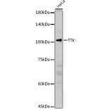 Western Blot - Anti-TTK/Mps1 Antibody (A14012) - Antibodies.com